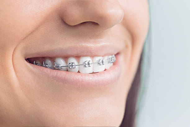 Best Wisdom Tooth Removal  in Dulles Town Center, VA